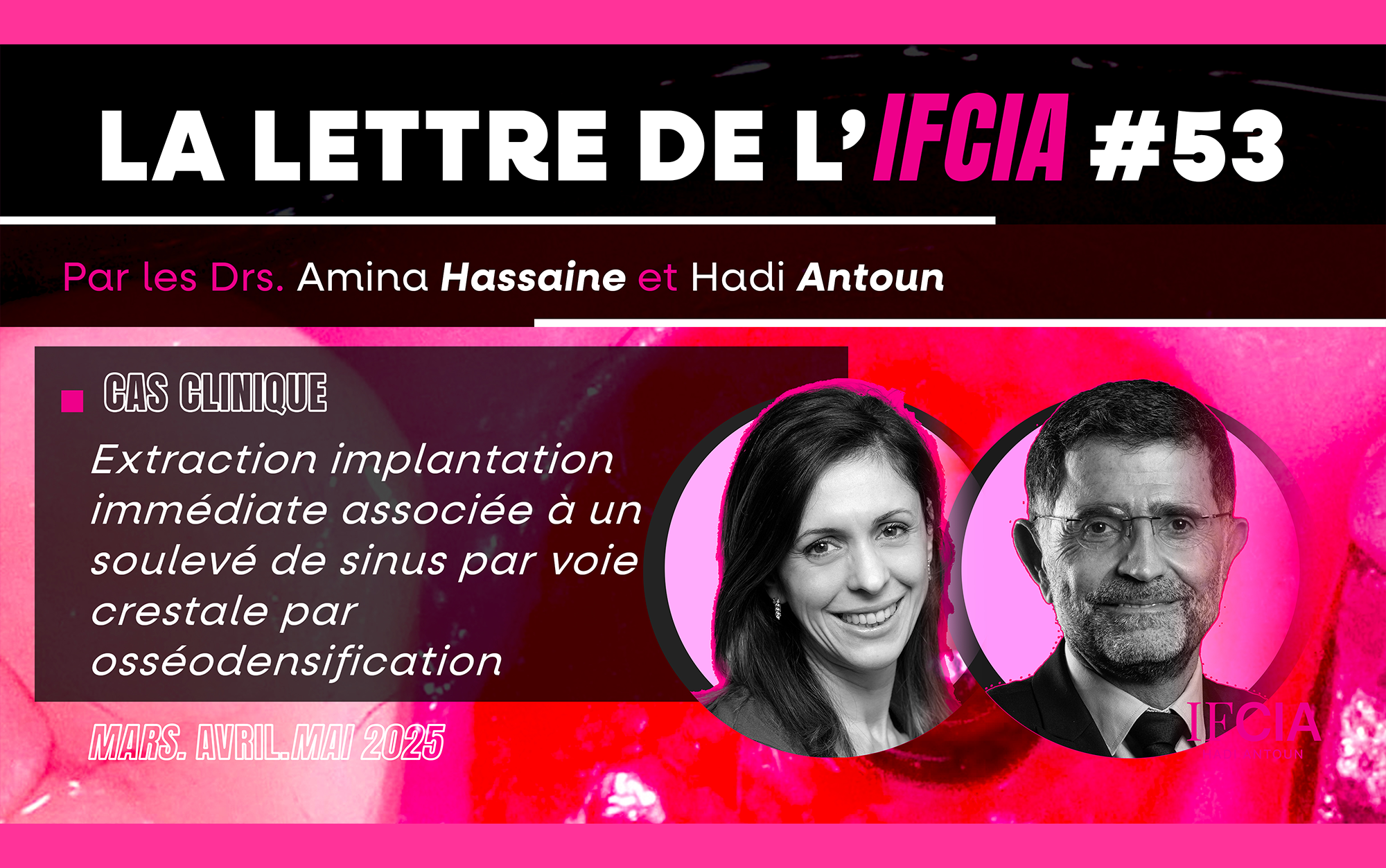 La Lettre de l'IFCIA 53