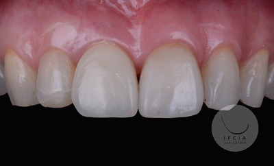 photo ifcia-hadi-antoun-les-implants-en-secteur-esthetique-2C.webp