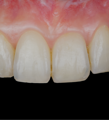 Formation  les-implants-en-secteur-esthetique